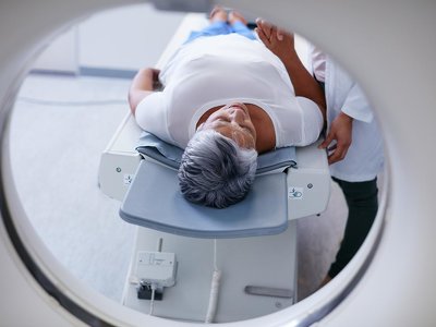 Na całym świecie młodzi coraz częściej chorują na raka. A naukowcy nie wiedzą dlaczego