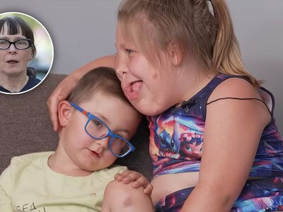 Guz zniekształcił buzię małej Nikoli. Nadzieja w wybitnych specjalistach od przeszczepów