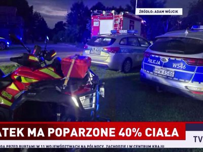 Ośmioletnie dziecko poparzone płonącą benzyną