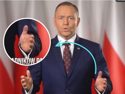 Przyjrzał się kciukowi prezydenta. Ruszyło śledztwo. Fotograf Nawrockiego reaguje!