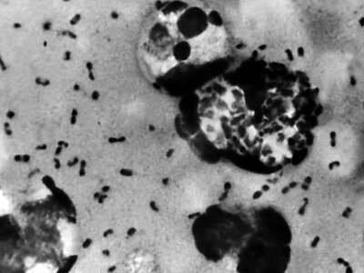 Epidemia dżumy w Rosji? Pierwszy śmiertelny przypadek na Syberii