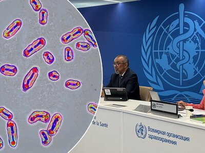 Śmierć 28-letniej Darii z powodu dżumy. WHO oceniła ryzyko epidemii