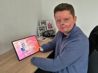W wypadku zginął przyjaciel, on stracił obie dłonie. Siedzi to w mojej głowie