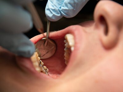 Upokarzające. Dentystka zniszczyła jej zęby. Tyle przyznał sąd