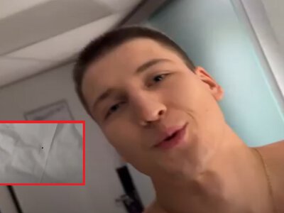 Myślał, że pogryzły go komary. Rosjanin pokazał, co go spotkało w Holandii